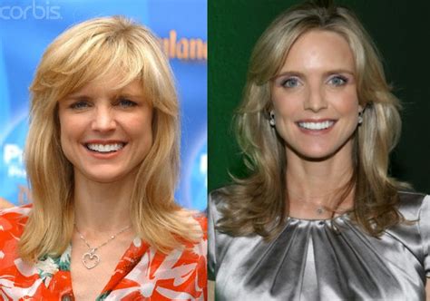 courtney thorne-smith|courtney thorne smith plastic surgery.